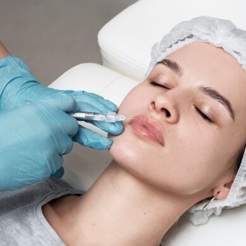 tratamiento-aumento-de-labios-con-acido-hialuronico