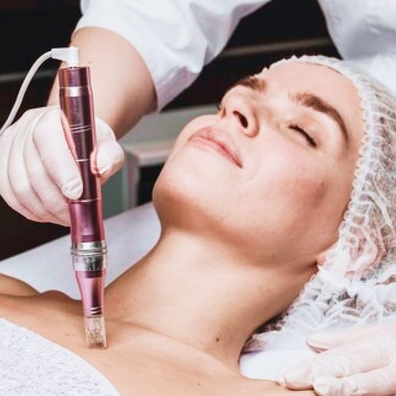 tratamiento-mesoterapia-virtual-para-cuello-y-escote
