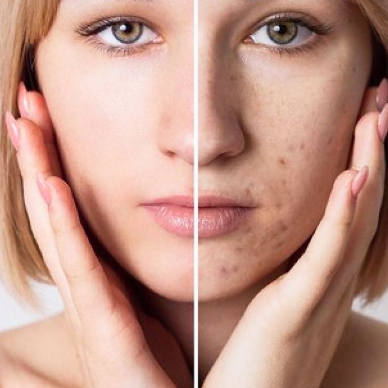 tratamiento-bb-glow-efecto-porcelana