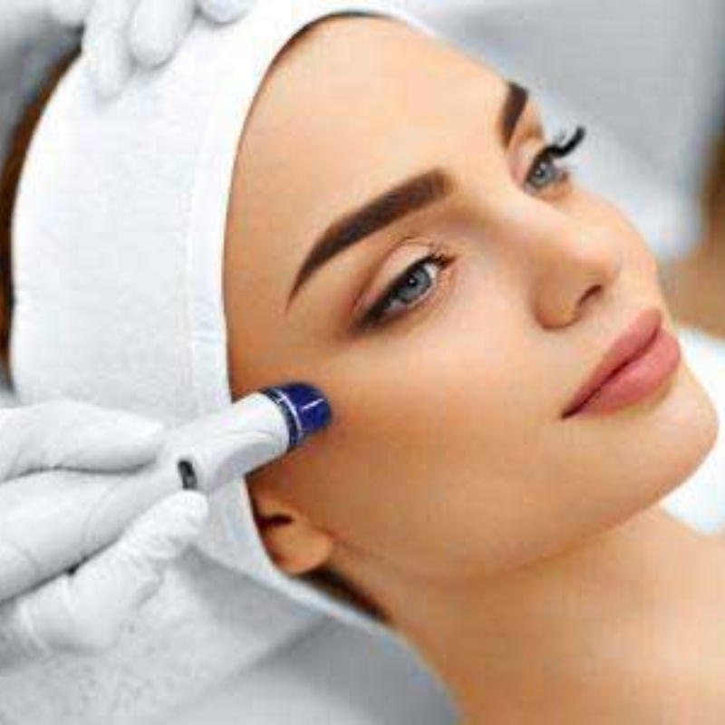 rejuvenecimiento-facial-con-dermapen