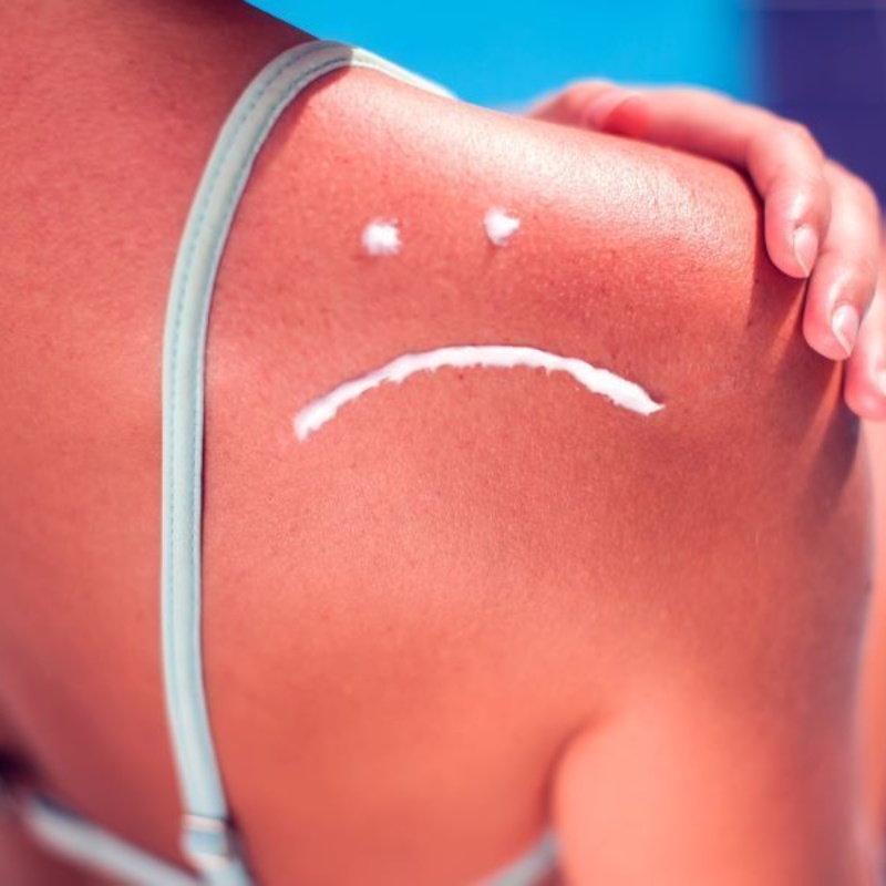 cuidado-con-tomar-el-sol