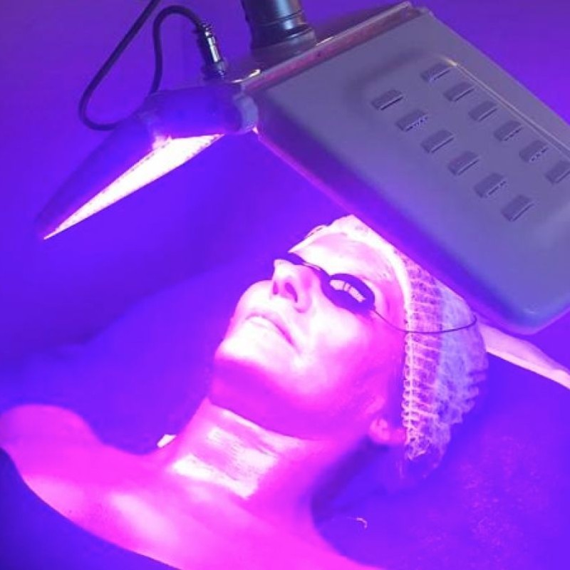 tratamiento-terapia-facial-con-luz-led-bioestimulacion-luminica