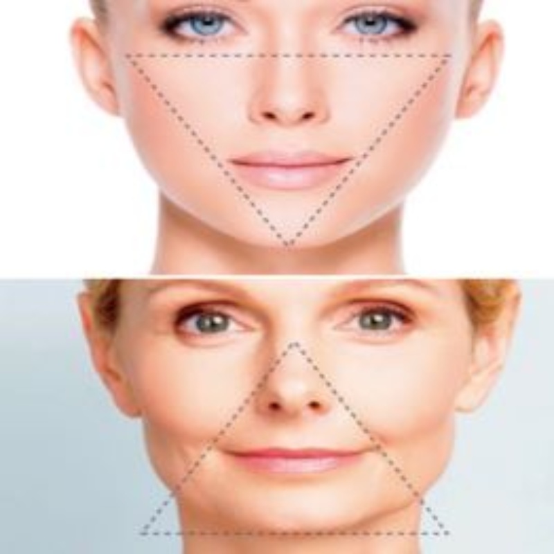 triangulo-de-la-belleza