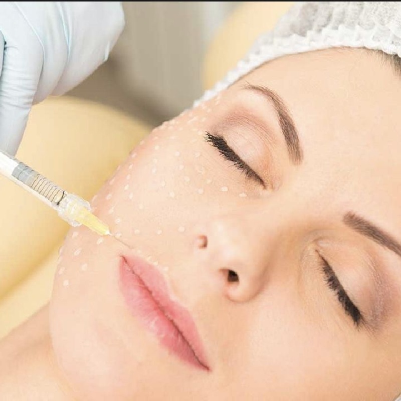 que-es-la-mesoterapia-facial