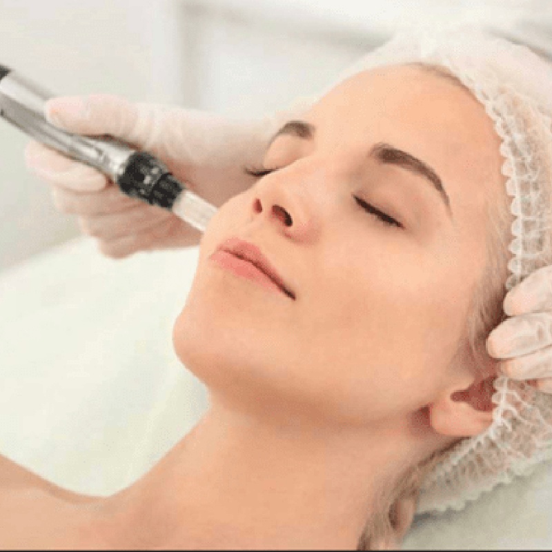 microneedling