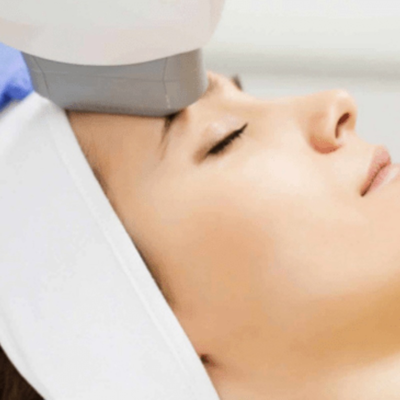 rejuvenecimiento-facial-con-ipl