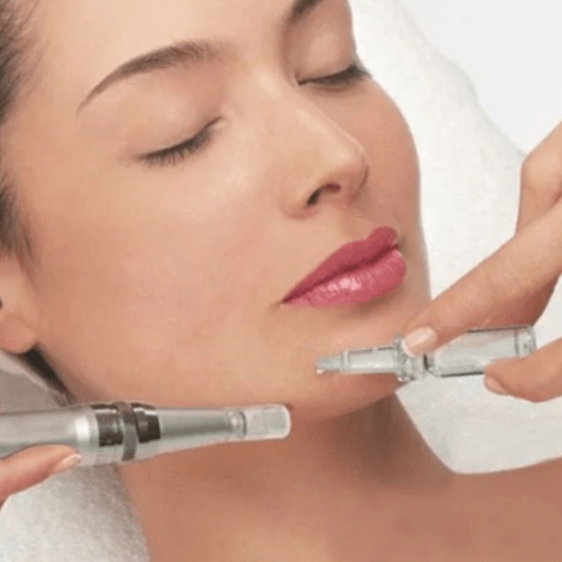 que-es-el-microneedling