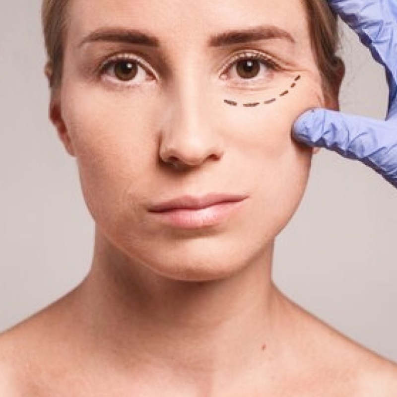 tratamiento-facial-antiedad-con-hilos-liquidos-de-colageno-y-acido-hialuronico