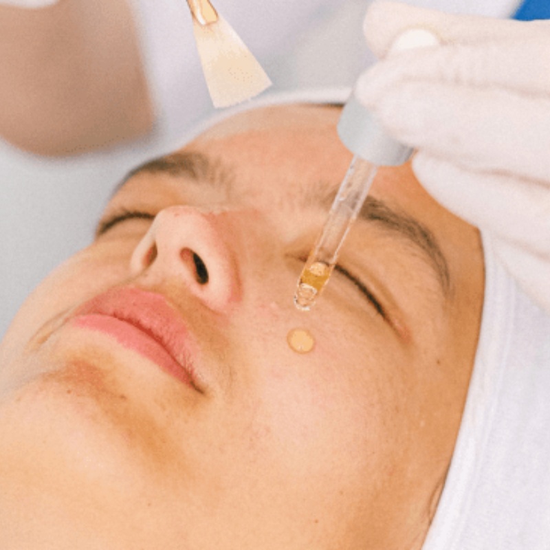 peeling-y-limpieza-facial