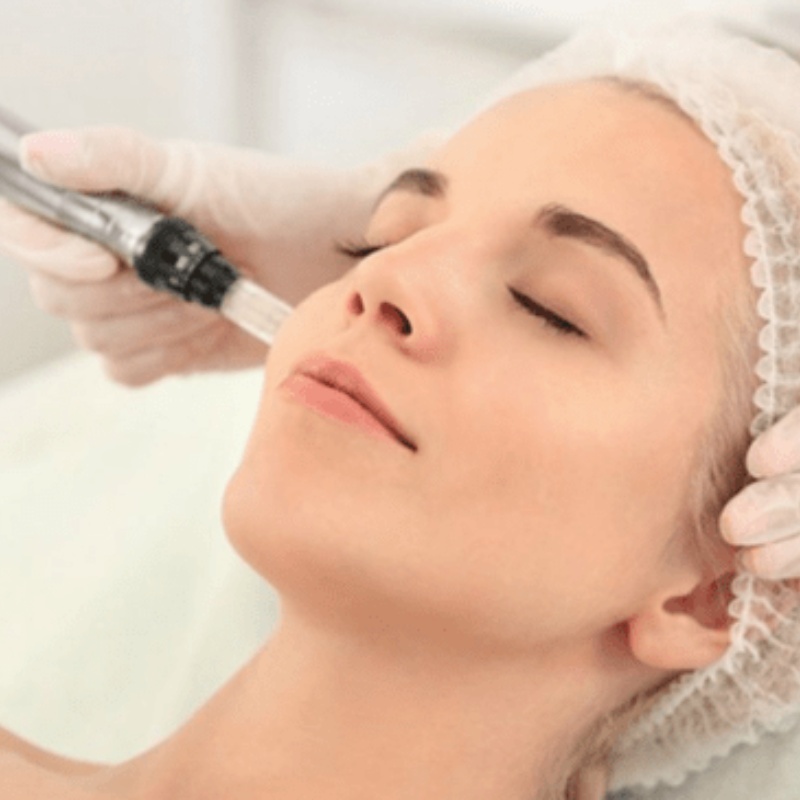 dermapen