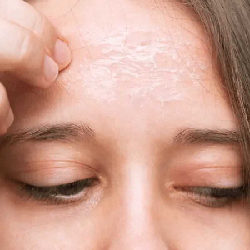 crema-piel-seca