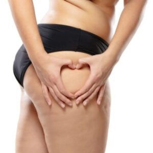 que-es-y-como-se-forma-la-celulitis