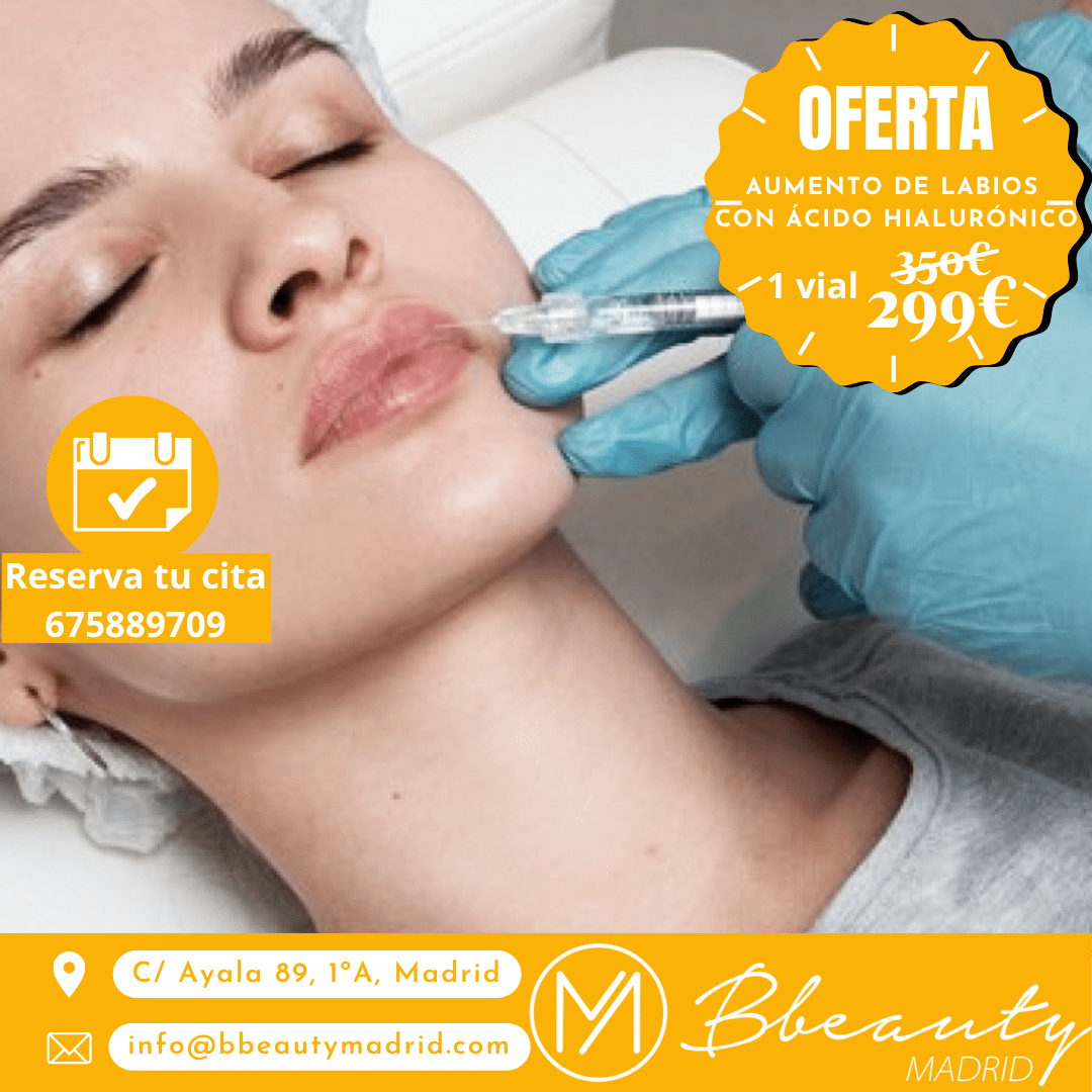 oferta-aumento-de-labios-con-acido-hialuronico-1-vial-1